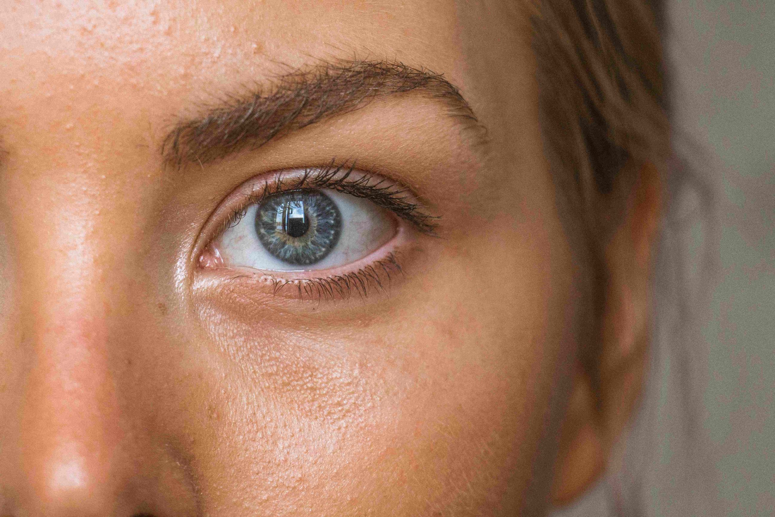 radio-frequency-skin-tightening-sunshine-coast